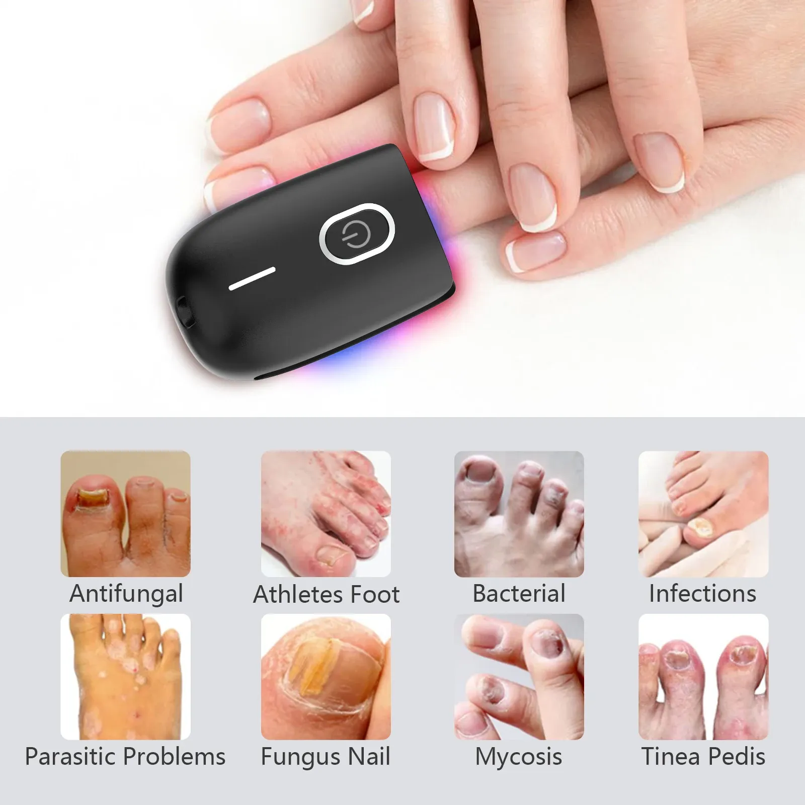 KTS Nail Repair Device for Fungal Infections and Onychomycosis-KTS HEALTHCARE