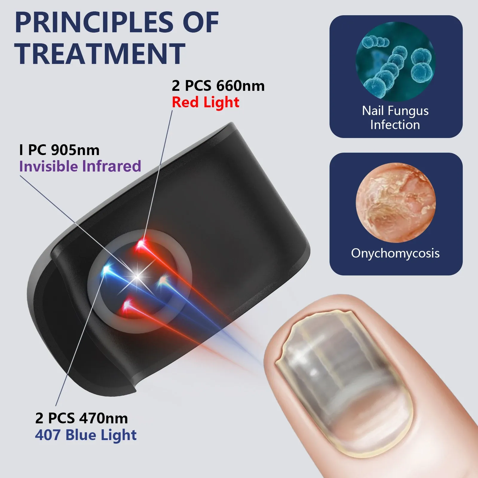 KTS Nail Repair Device for Fungal Infections and Onychomycosis-KTS HEALTHCARE