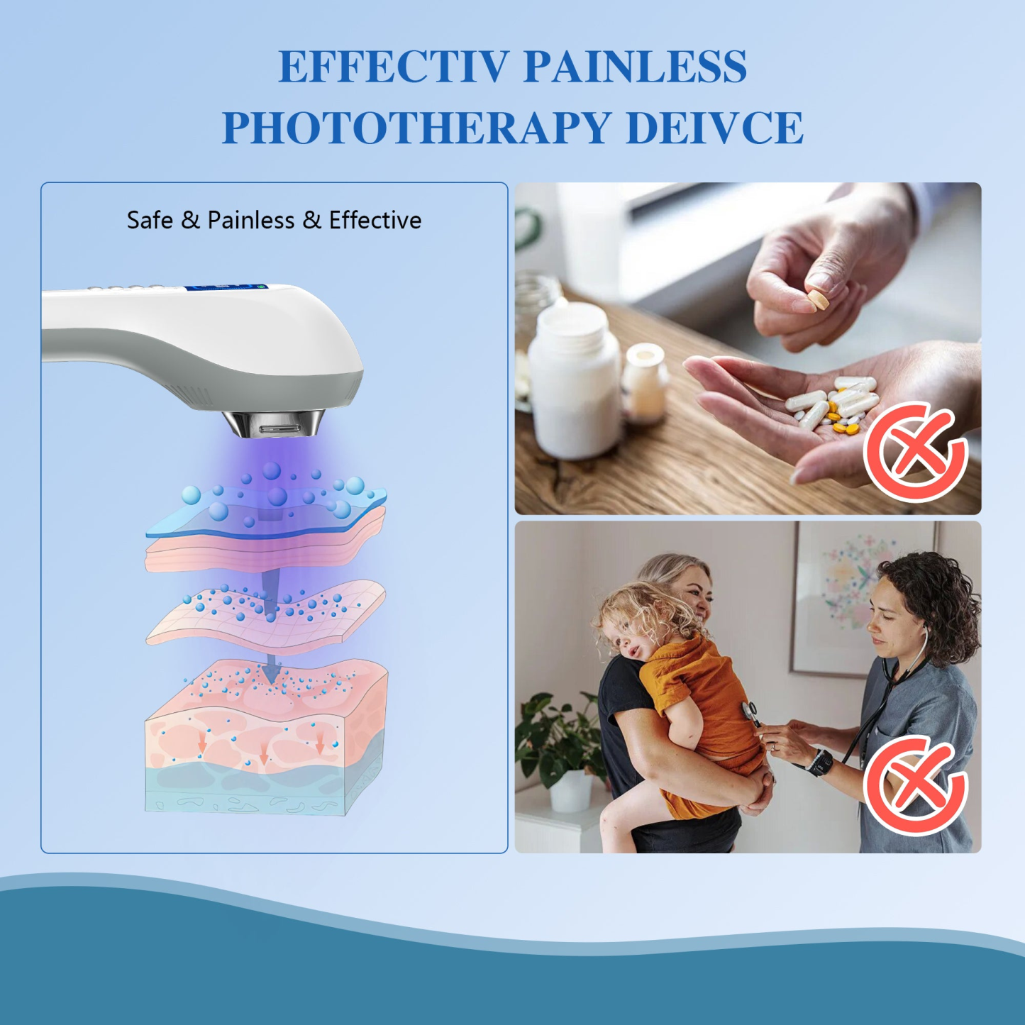 Handheld UVB Light Therapy Device for Vitiligo, Psoriasis & Eczema