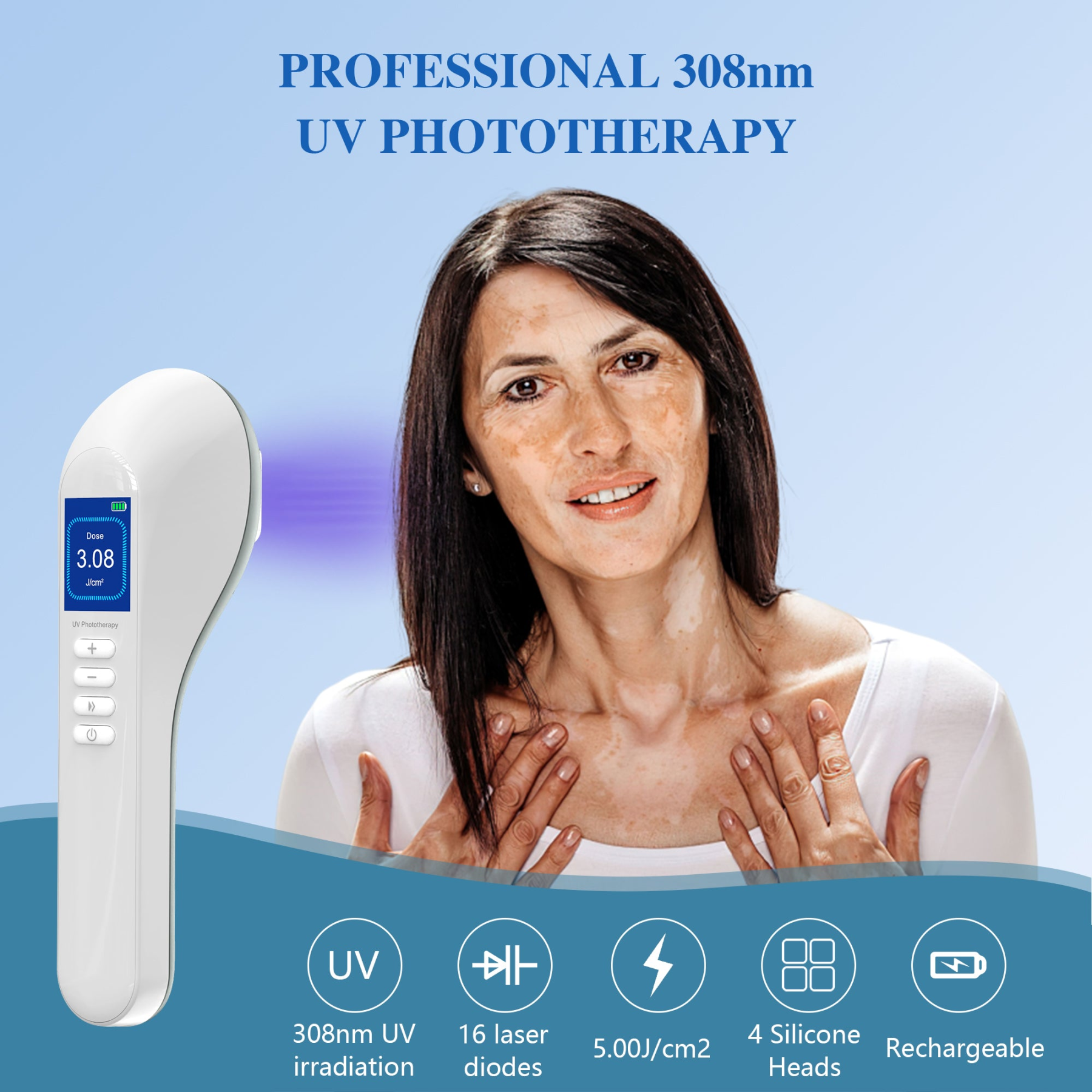 Handheld UVB Light Therapy Device for Vitiligo, Psoriasis & Eczema