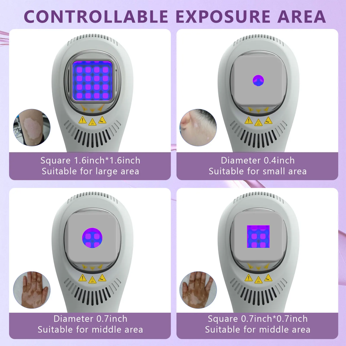 Handheld UVB Light Therapy Device for Vitiligo, Psoriasis & Eczema
