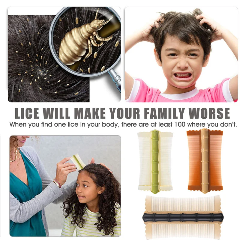 Lice Comb (Fast Removal of Lice Eggs, Nits and Dandruff)