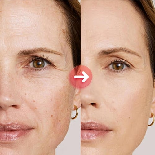 Gentle whitening