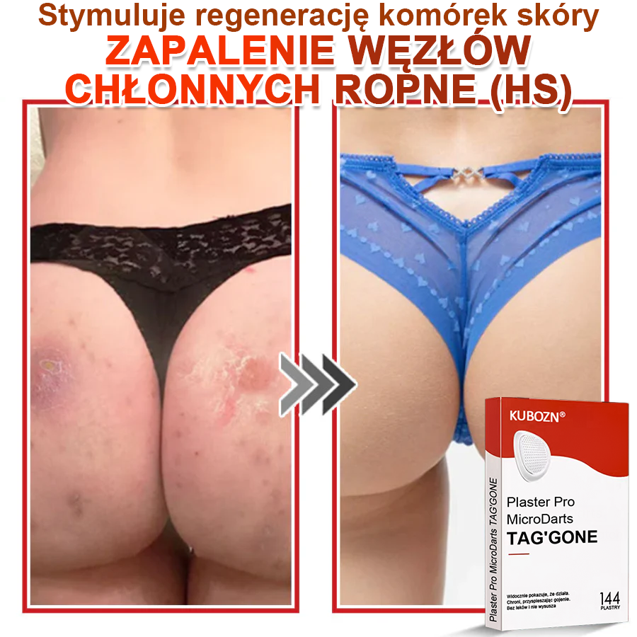 🌈 KUBOZN® Mikroigłowy Botaniczny Plaster na Usuwanie Brodawek Skórnych