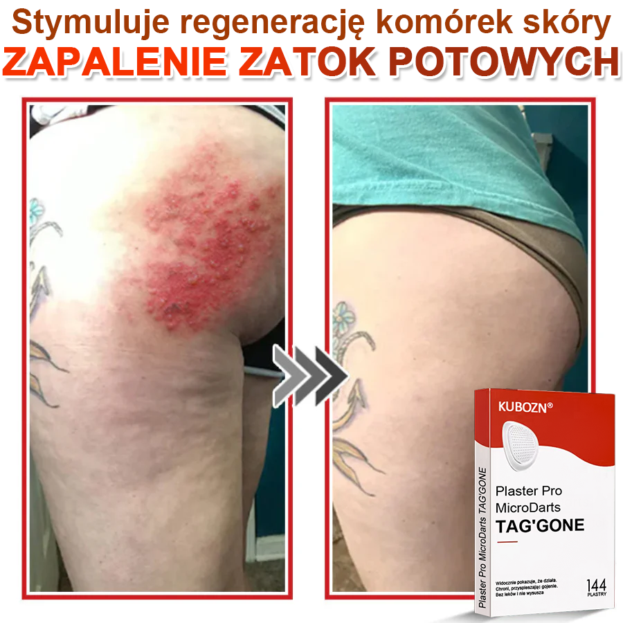 🌈 KUBOZN® Mikroigłowy Botaniczny Plaster na Usuwanie Brodawek Skórnych