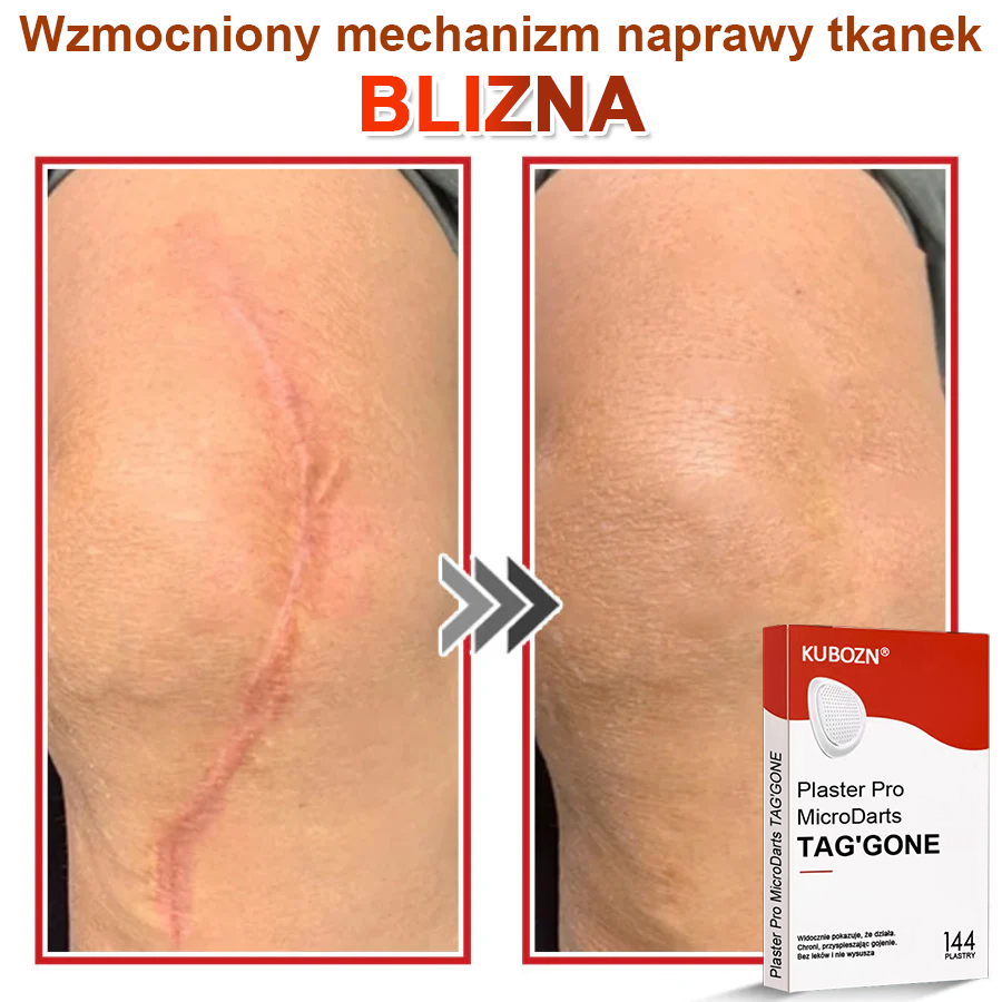 🌈 KUBOZN® Mikroigłowy Botaniczny Plaster na Usuwanie Brodawek Skórnych
