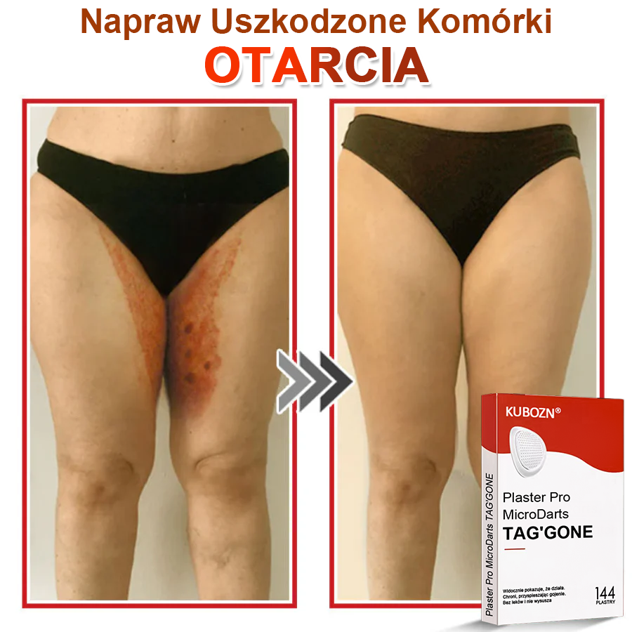 🌈 KUBOZN® Mikroigłowy Botaniczny Plaster na Usuwanie Brodawek Skórnych