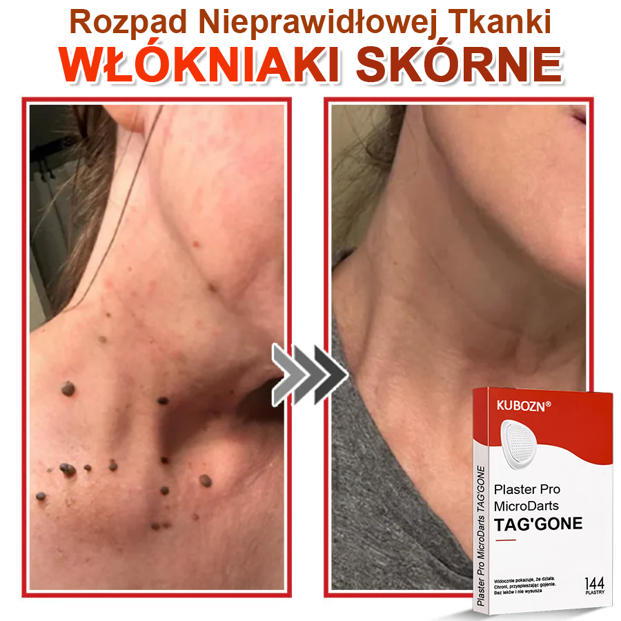 🌈 KUBOZN® Mikroigłowy Botaniczny Plaster na Usuwanie Brodawek Skórnych