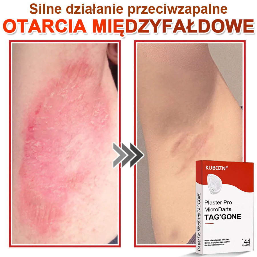 🌈 KUBOZN® Mikroigłowy Botaniczny Plaster na Usuwanie Brodawek Skórnych