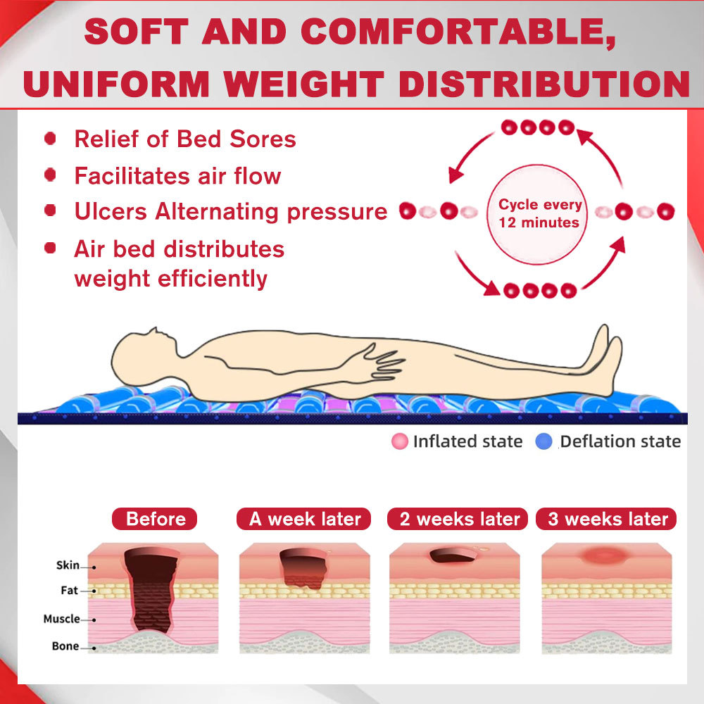 Bed Sore Treatment Medical Hospital Bed Alternating Pressure Pad Mattress Topper