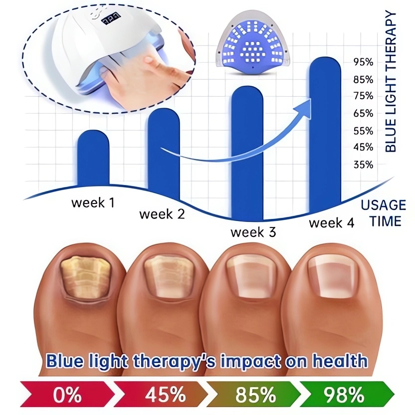 ✨Last Day Discount 62% OFF💥 - PureNail Fungus Laser Device