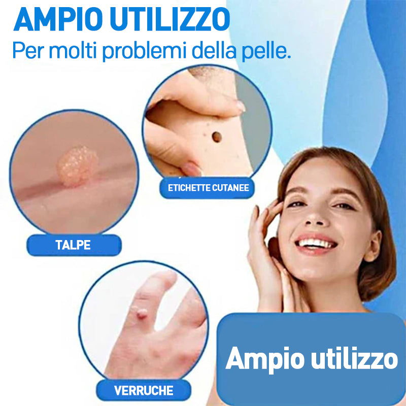 2 in 1 Wart Removal Tool