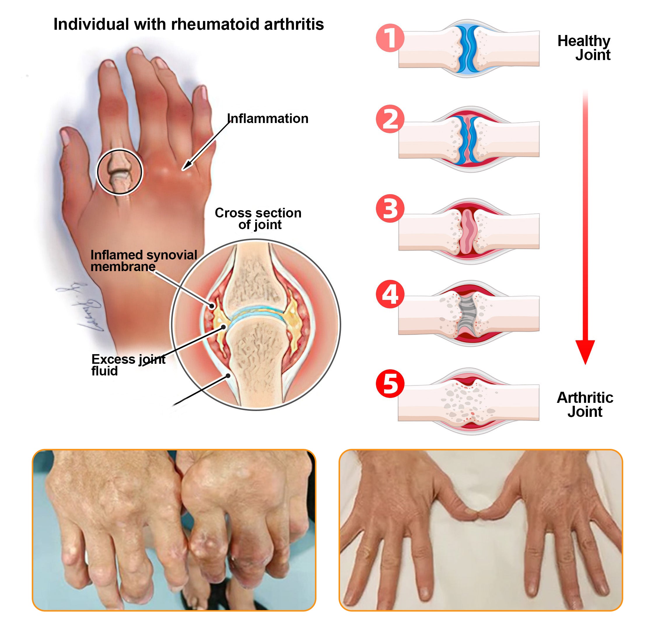  Botulinum Toxin & Bee Essence Pain-Relief Bone Healing Cream