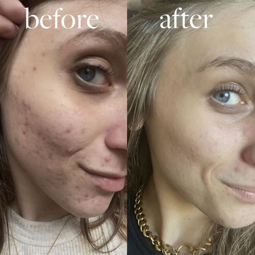 Enlumni® 4-in-1 Radiant Anti-Aging Skincare Wand