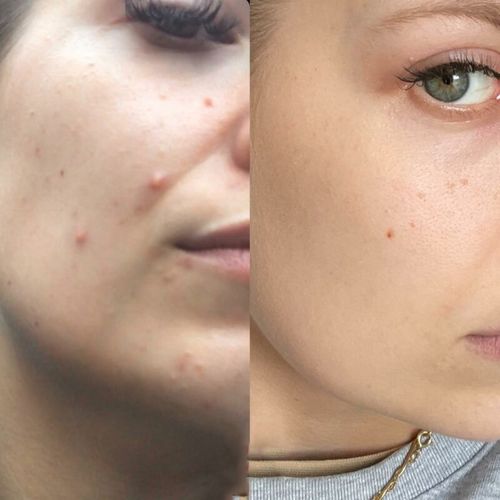 Enlumni® 4-in-1 Radiant Anti-Aging Skincare Wand