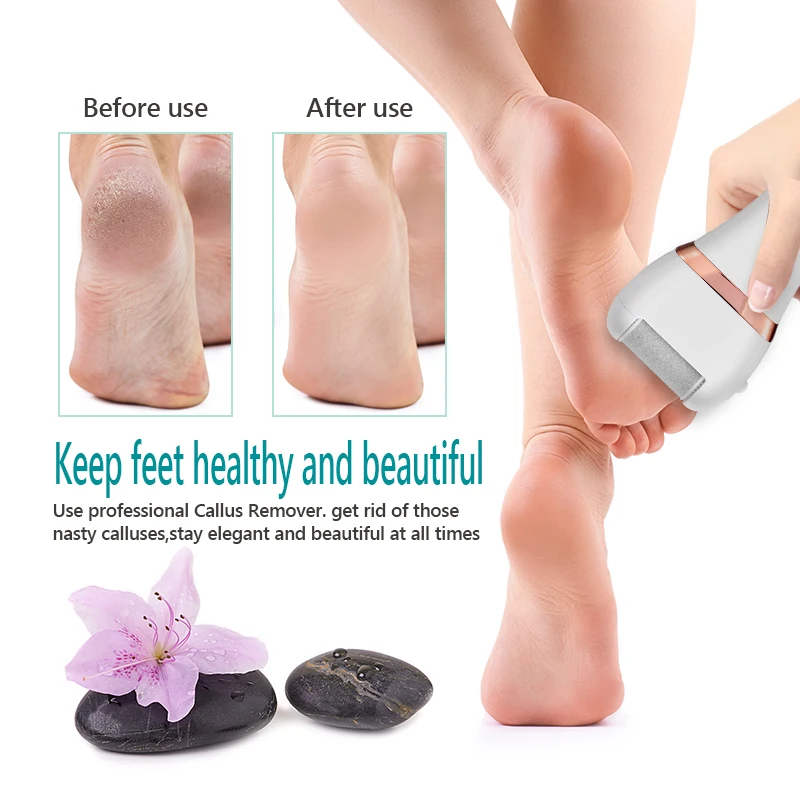 Professional foot care tool LED LCD display