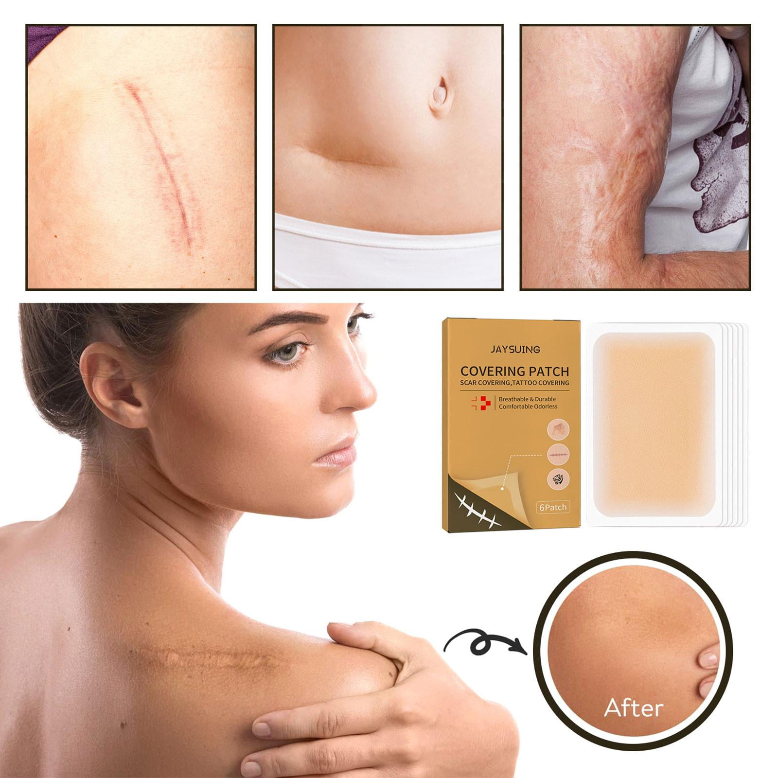Invisible scar repair concealer patch（Can be cut at will）