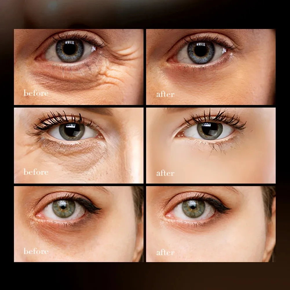 SADOER Retinol Caffeine Anti-Wrinkle Series