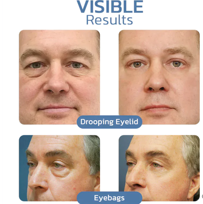 OPENEYES™ Awaken Peptide Lifting Eye Gel