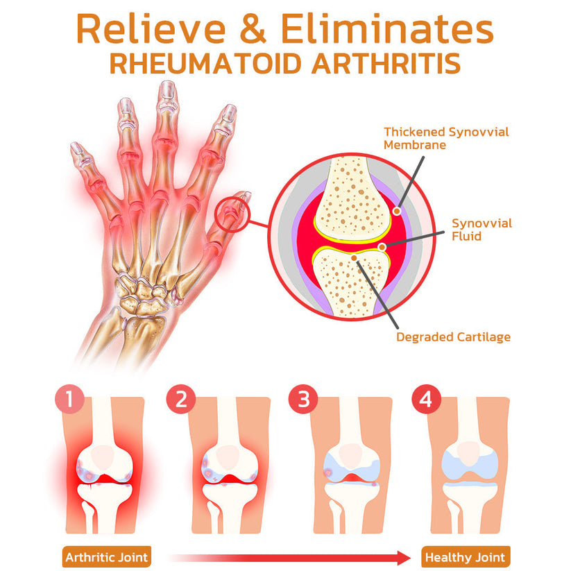  GFOUK™ Bee Venom Joint and Bone Therapy Spray