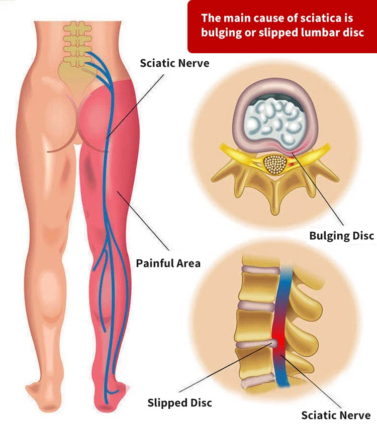 Northern Huatuo Lumbar Spine Spray