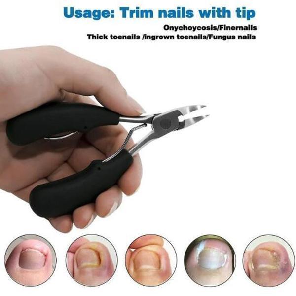 Medical grade nail clippers