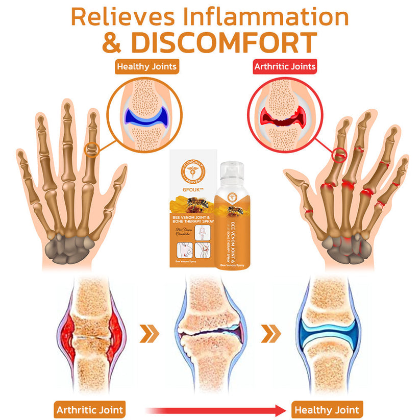  GFOUK™ Bee Venom Joint and Bone Therapy Spray