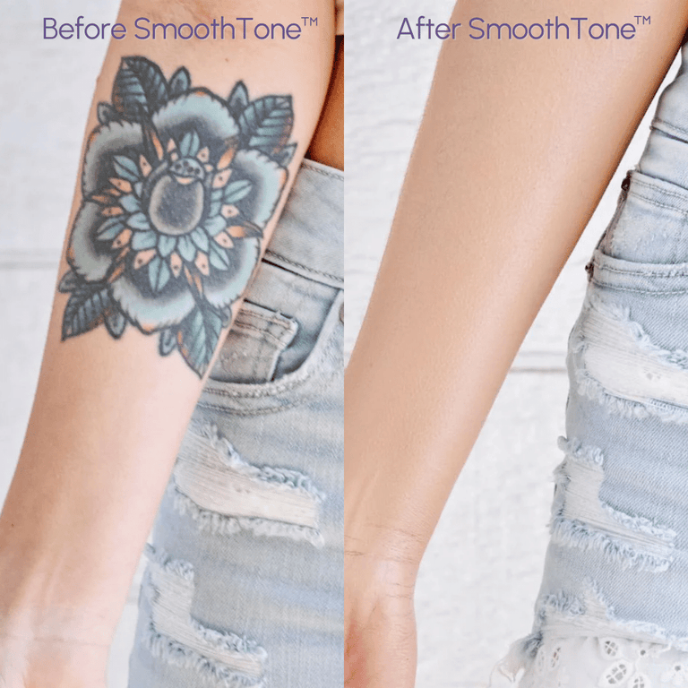 SmoothTone – Full Coverage Body Makeup