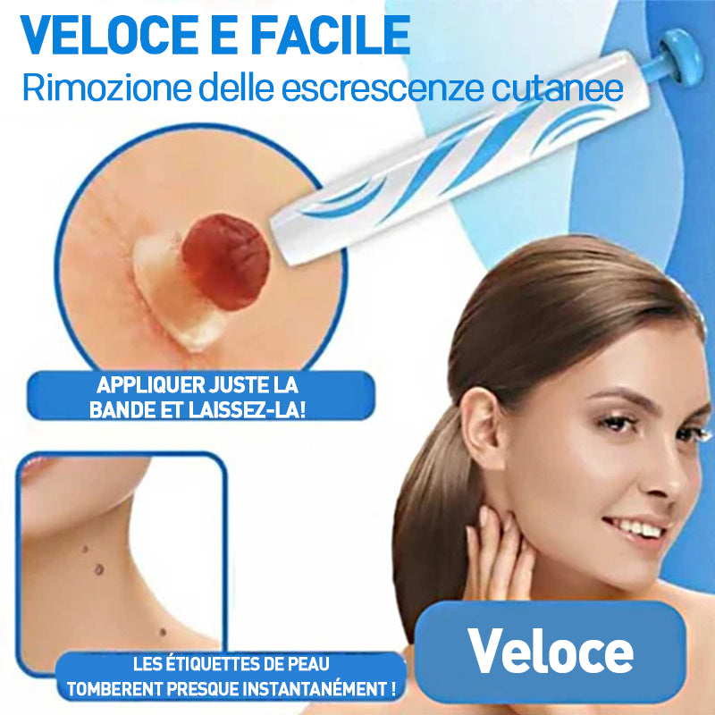 2 in 1 Wart Removal Tool