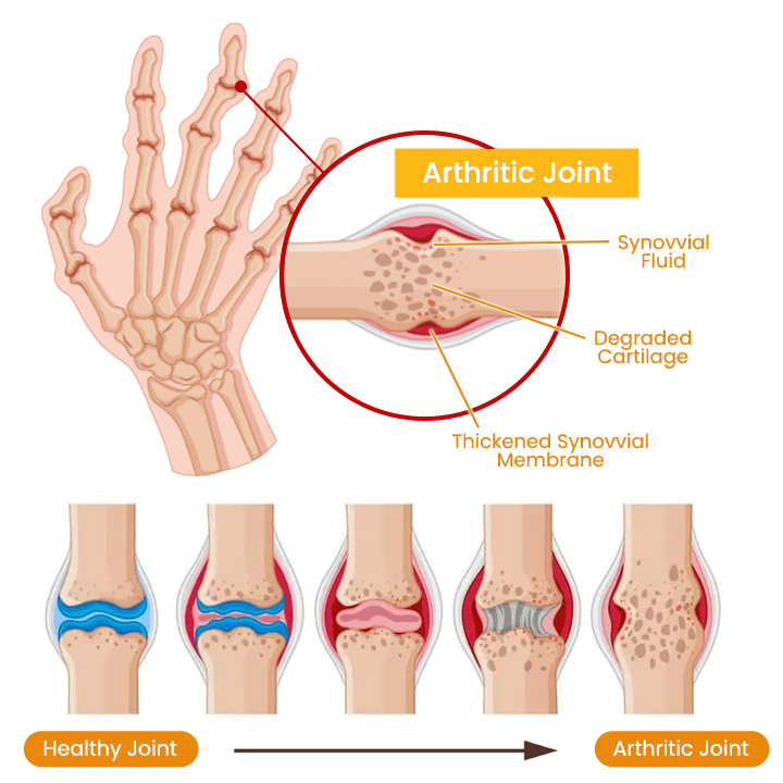 BeeVenom Joint Repair Cream