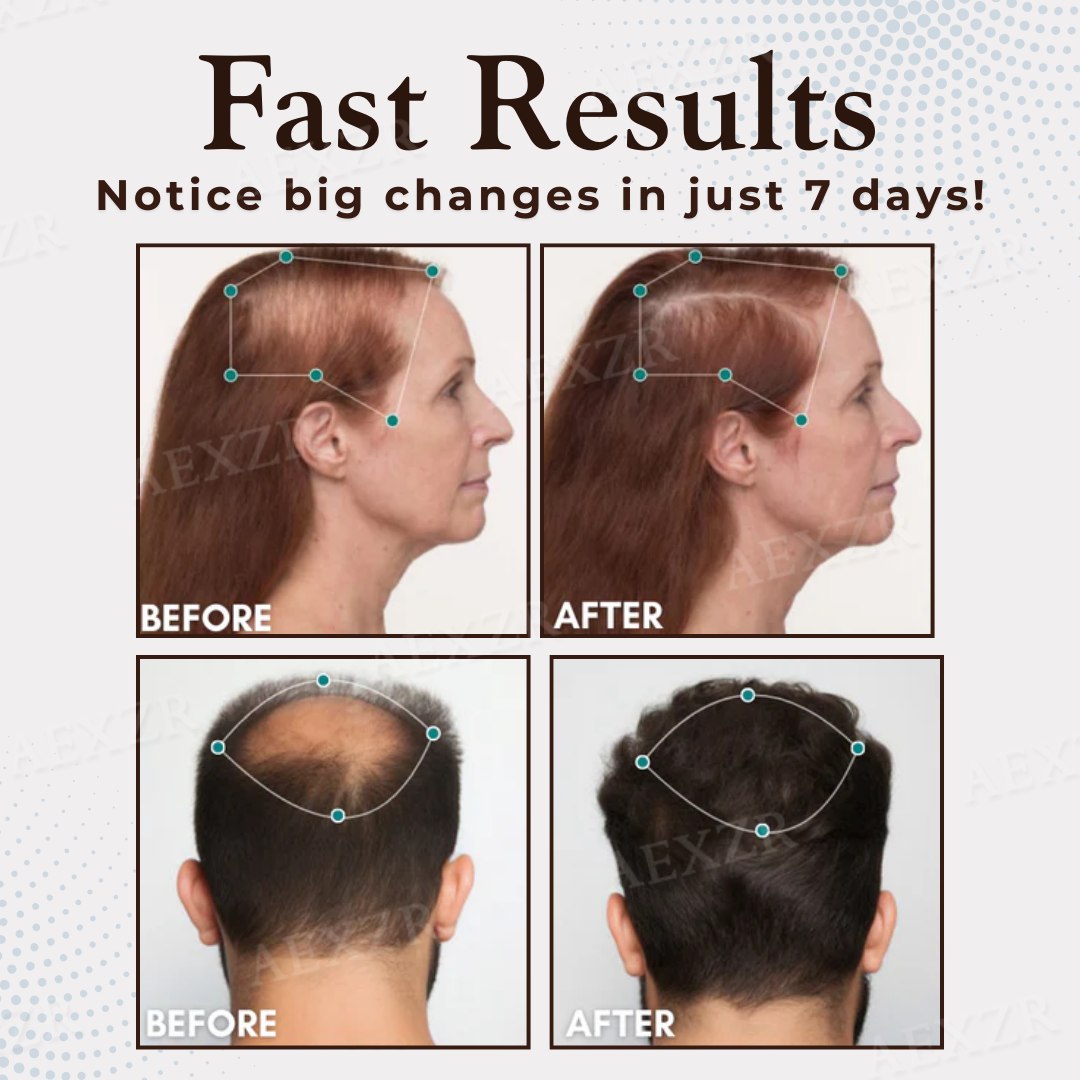 Hair Regrowth Capsules