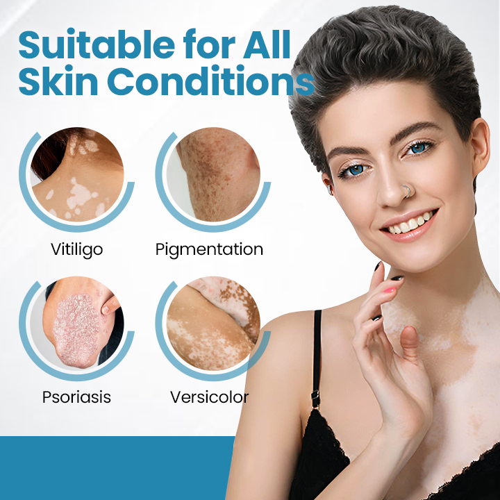 DermaBeam Vitiligo Therapy Device