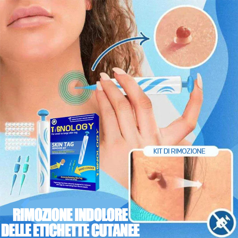 2 in 1 Wart Removal Tool