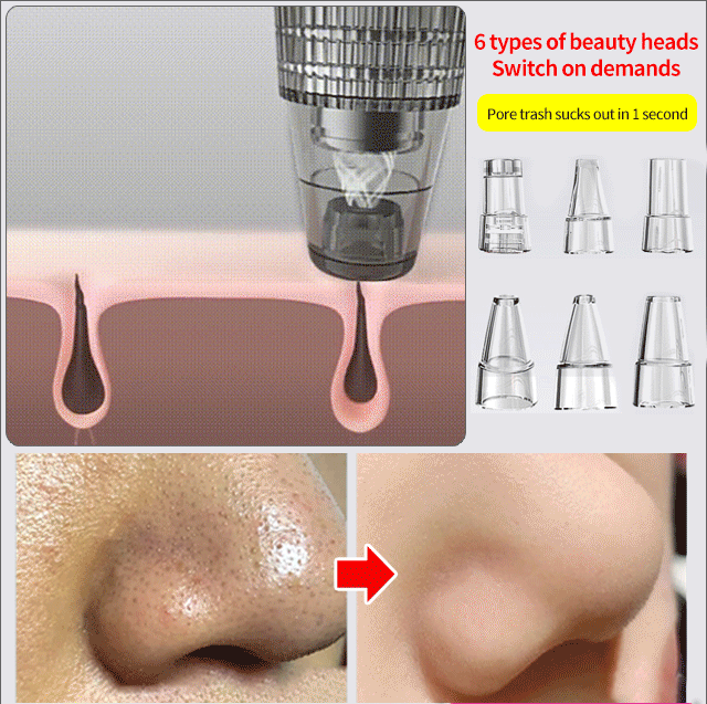 Electric Blackhead Remover Beauty Instrument