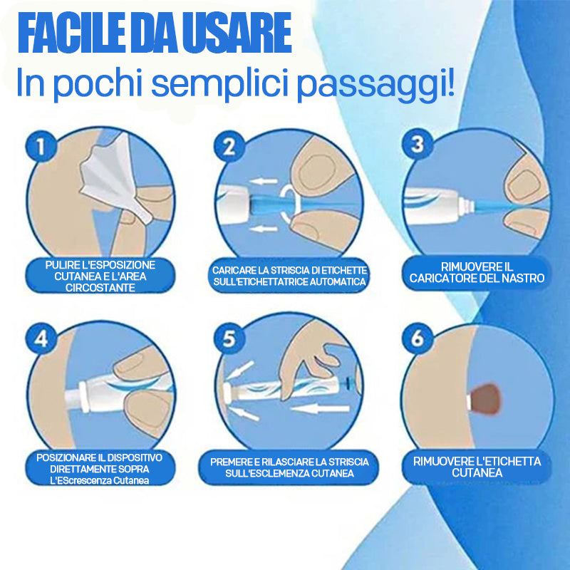 2 in 1 Wart Removal Tool