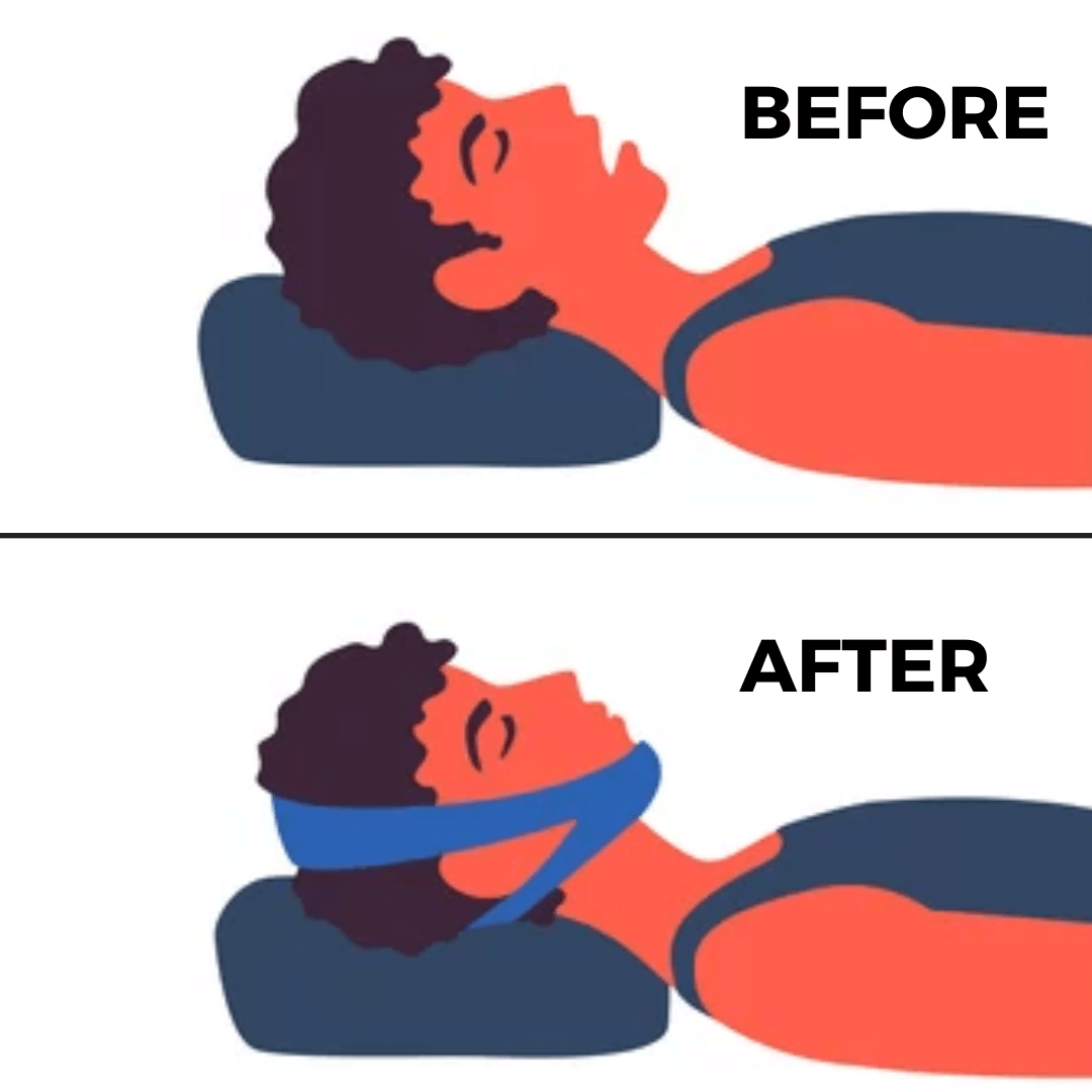  💥AirFlow Jaw Strap💥