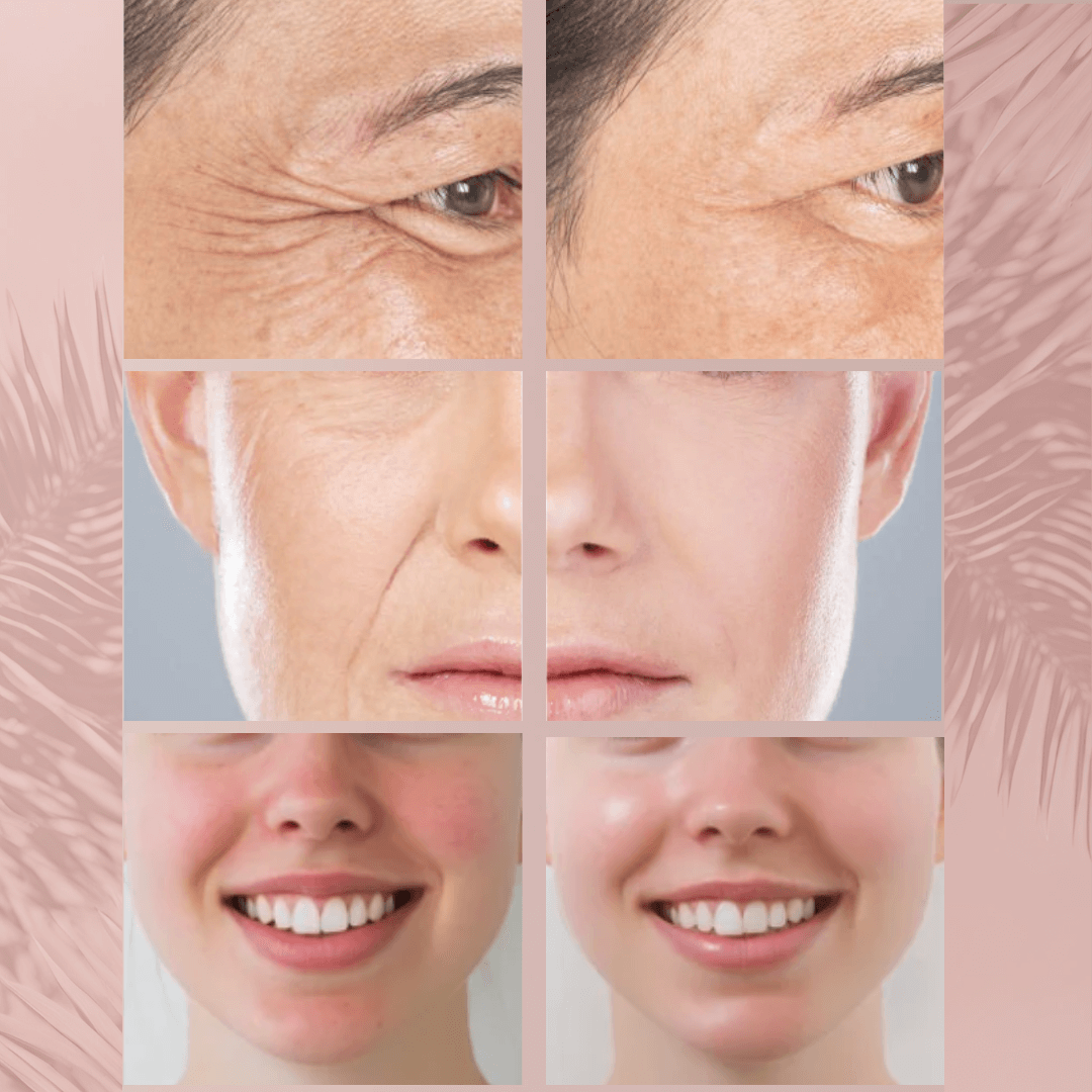 Pro LED Facial Mask