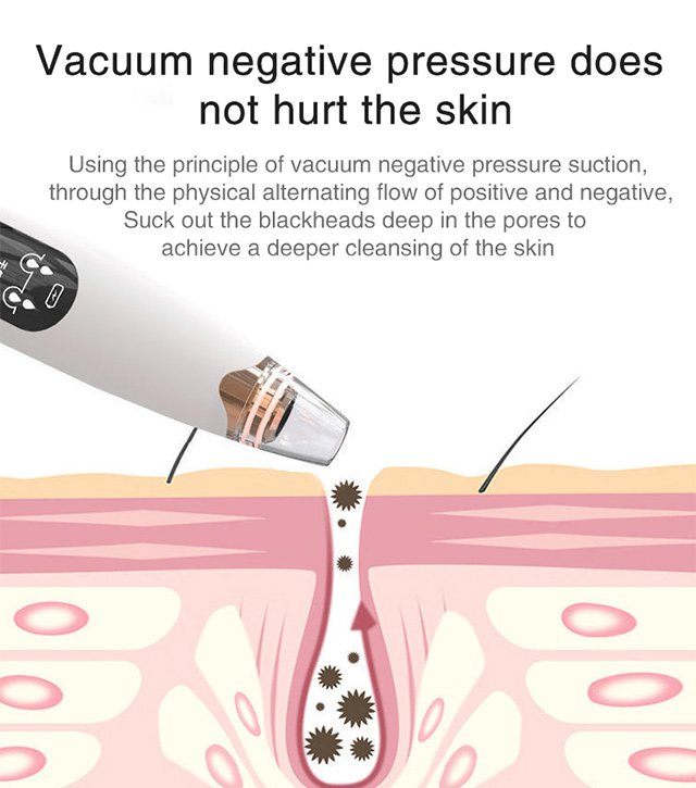 Electric Blackhead Remover Beauty Instrument