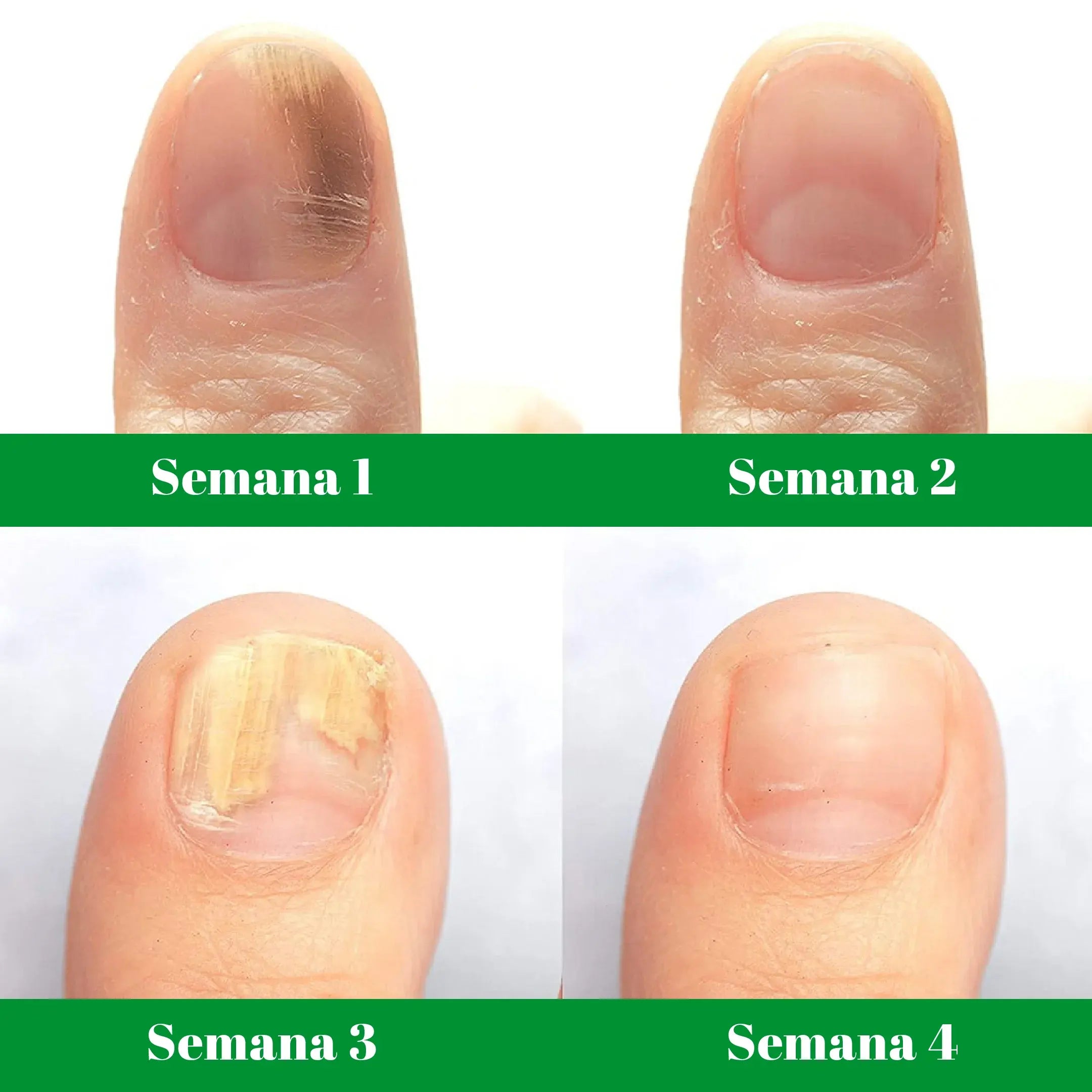 Terbinafine eye drops for fungal control