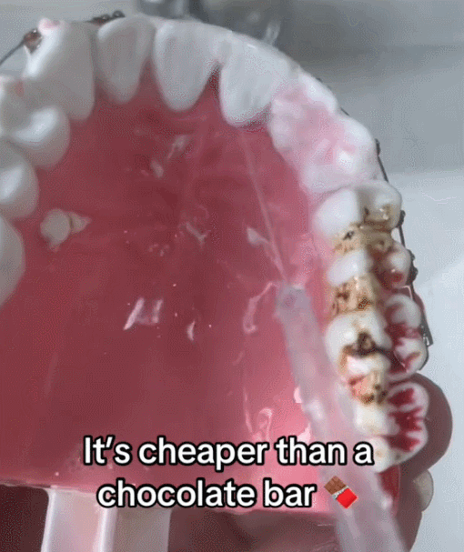 Hydropulsetech™ Oral Irrigator