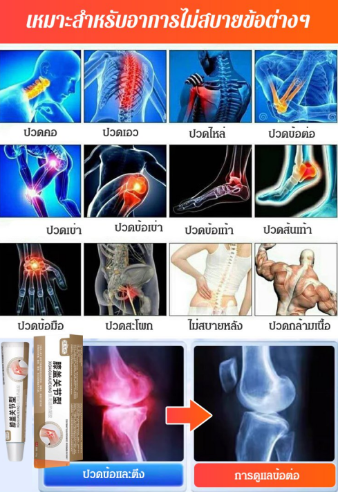 Knee joint type medical pain relief gel