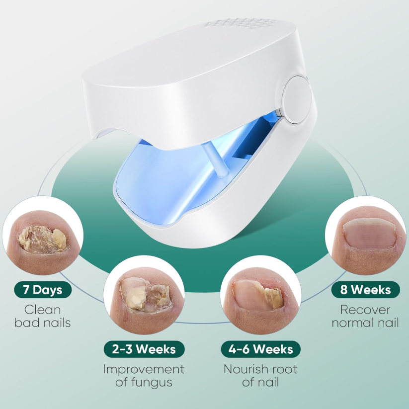 Nail Fungus Cleaning Light for Onychomycosis