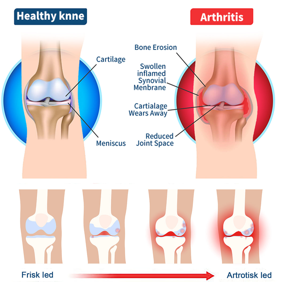 Bee poison Pain ArthritisTherapy Cream (specially forolder adults & AAOSrecommends)