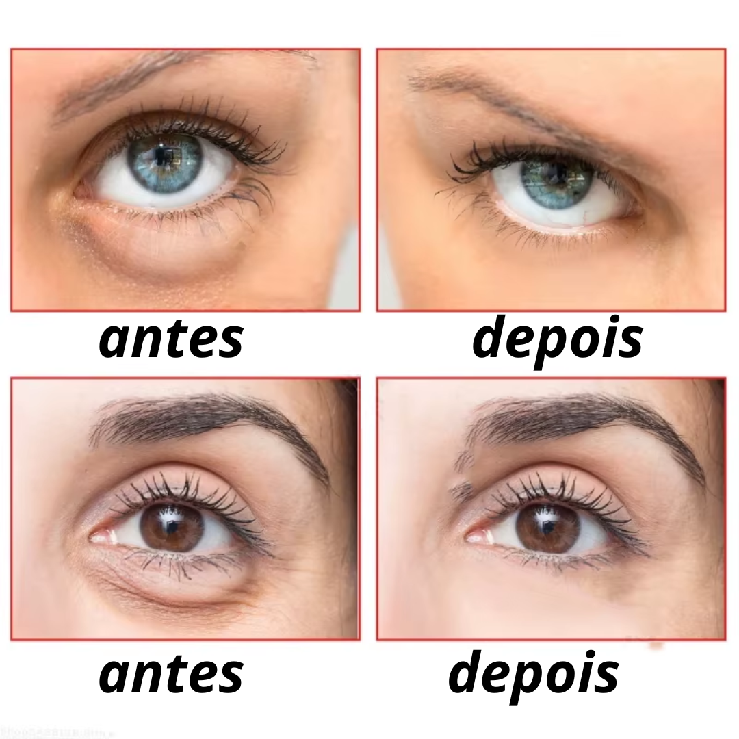 5-in-1 Lutein Ultra-Revitalizing Roller