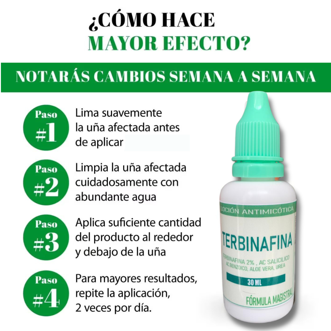 Terbinafine eye drops for fungal control