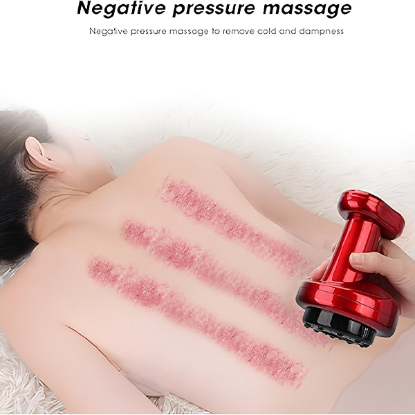 CUPPY Electric Cupping Machine