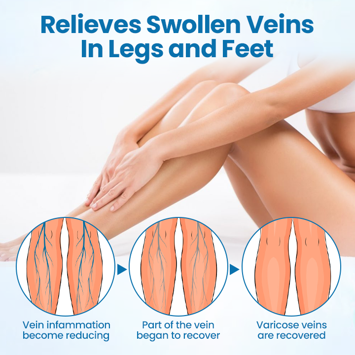 VeinGuard Herbal Spray