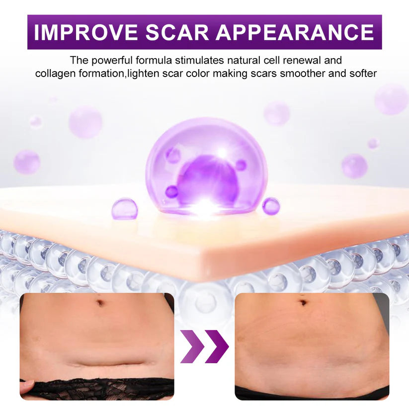 Scar Gel – Clinically Proven Formula to Soften, Flatten & Fade Scars from Surgery, Acne, Burns, and Keloids