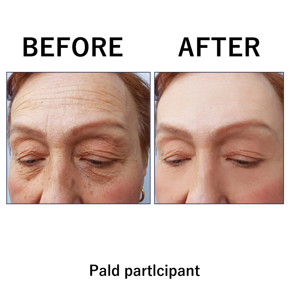 🔥【Official Brand Store】Instant FIRMx Temporary Face Tightener