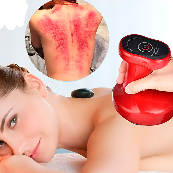 CUPPY Electric Cupping Machine